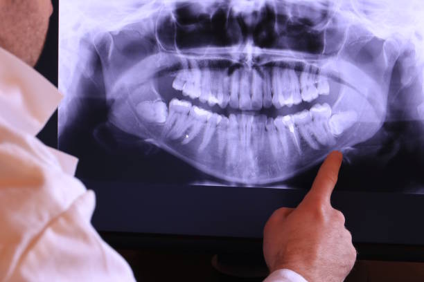 Best Broken or Cracked Tooth Emergency Dentist in Columbiana, AL